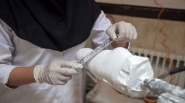 تولید ارتز، پروتز و اندام‌های مصنوعی برای نخستین‌بار در ایران 